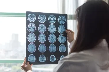 Overcoming Barriers To AI Medical Scans